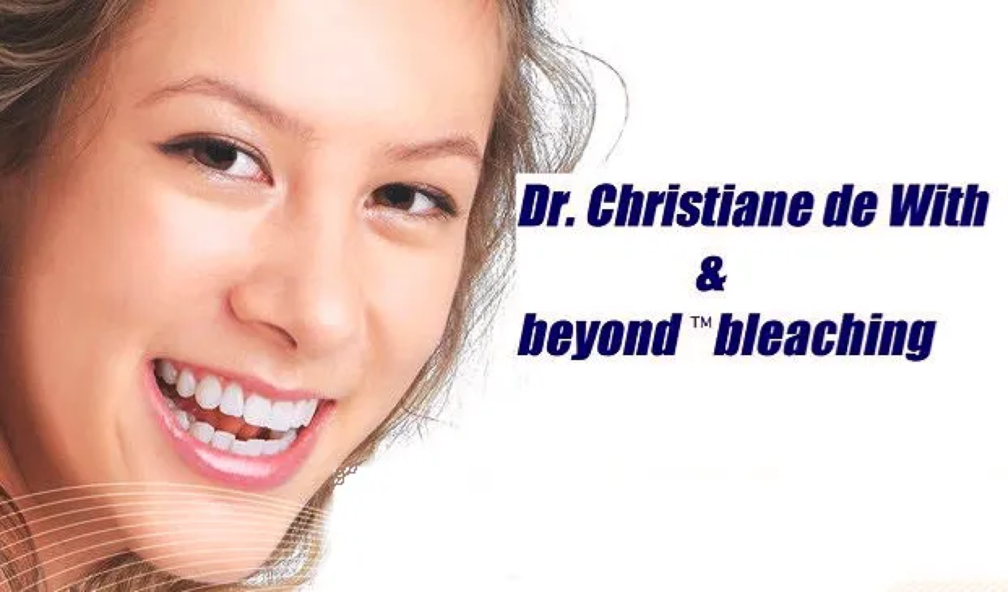 Zahnaufhellung in meiner Praxis mit Beyond Bleaching